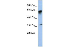 WB Suggested Anti-PRR18 Antibody Titration: 0. (Proline Rich 18 anticorps  (Middle Region))