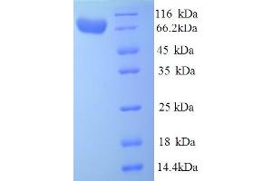 SDS-PAGE (SDS) image for Iduronidase, alpha-L- (IDUA) (AA 28-653) protein (His tag) (ABIN5713524)