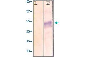 The cell lysate derived from MCF-7 was immunoprobed by RHO polyclonal antibody  at 1 : 500. (Rho-related GTP-binding protein anticorps  (C-Term))