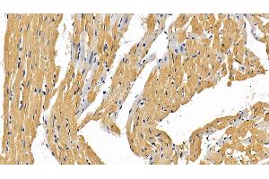 Detection of RIPK1 in Rat Cardiac Muscle Tissue using Polyclonal Antibody to Receptor Interacting Serine Threonine Kinase 1 (RIPK1) (RIPK1 anticorps  (AA 1-179))