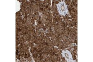Immunohistochemical staining of human pancreas with CLCN4 polyclonal antibody  shows strong cytoplasmic positivity in exocrine cells. (CLCN4 anticorps)