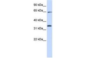Image no. 1 for anti-Ras Homolog Gene Family, Member T1 (RHOT1) (AA 396-445) antibody (ABIN6740909) (RHOT1 anticorps  (AA 396-445))