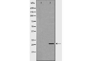 Western blot analysis of Jurkat  using RAC2 antibody. (RAC2 anticorps  (C-Term))