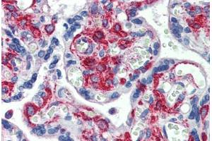 Human Placenta: Formalin-Fixed, Paraffin-Embedded (FFPE)