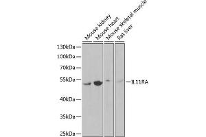 Western blot analysis of extracts of various cell lines, using IL11RA Antibody (ABIN6129037, ABIN6142294, ABIN6142295 and ABIN6222319) at 1:1000 dilution. (IL11RA anticorps  (AA 30-290))