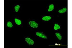 Immunofluorescence of monoclonal antibody to TCF7 on HeLa cell.