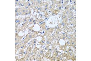 Immunohistochemistry of paraffin-embedded human liver injury using TUBGCP3 antibody at dilution of 1:100 (x40 lens). (TUBGCP3 anticorps)