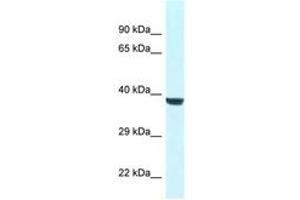 Image no. 1 for anti-WD Repeat Domain 45B (WDR45B) (AA 65-114) antibody (ABIN6747425) (WD Repeat Domain 45B (WDR45B) (AA 65-114) anticorps)