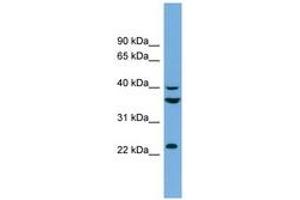 Image no. 1 for anti-SUMO1 Activating Enzyme Subunit 1 (SAE1) (AA 71-120) antibody (ABIN6743622) (SAE1 anticorps  (AA 71-120))
