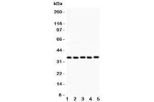 Western blot testing of HOXA11 antibody and Lane 1:  rat brain (Homeobox A11 anticorps  (AA 74-245))