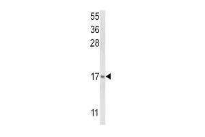Western blot analysis of LTC4S Antibody (N-term) (ABIN652524 and ABIN2842352) in NCI- cell line lysates (35 μg/lane). (LTC4S anticorps  (N-Term))
