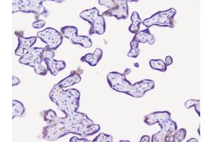 IHC analysis of NSE using anti-NSE antibody (ABIN6719549). (ENO2/NSE anticorps)
