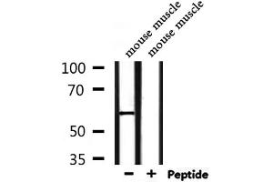 Western blot analysis of extracts from mouse muscle, using CD151 Antibody.