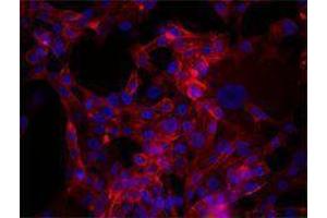 Immunofluorescence (IF) image for anti-CD44 (CD44) antibody (Alexa Fluor 647) (ABIN2657791) (CD44 anticorps  (Alexa Fluor 647))