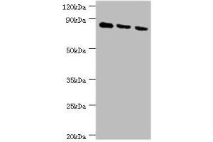 Western blot All lanes: CDH6 antibody at 6 μg/mL Lane 1: 293T whole cell lysate Lane 2: Hela whole cell lysate Lane 3: A549 whole cell lysate Secondary Goat polyclonal to rabbit IgG at 1/10000 dilution Predicted band size: 89, 74 kDa Observed band size: 89 kDa (CDH6 anticorps  (AA 1-250))