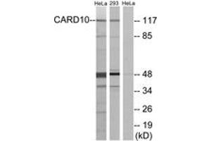 Western blot analysis of extracts from HeLa/293 cells, using CARD10 Antibody. (CARD10 anticorps  (AA 481-530))