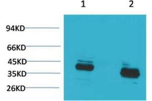 Western Blot (WB) analysis of 1) Mouse Brain Tissue, 2) Rat Brain Tissue with CABP Rabbit Polyclonal Antibody diluted at 1:2000. (S100G anticorps)