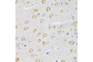 Immunohistochemistry of paraffin-embedded rat brain using OLR1 Antibody. (OLR1 anticorps)