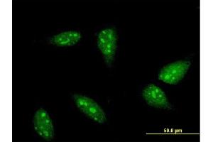 Immunofluorescence of monoclonal antibody to RNF6 on HeLa cell. (RNF6 anticorps  (AA 1-100))