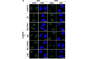 BRUCE UBC domain is required for RAD51 foci formation and HR repair.