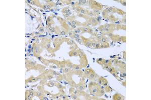 Immunohistochemistry of paraffin-embedded human stomach using HS1BP3 antibody (ABIN5974534) at dilution of 1/100 (40x lens). (HS1BP3 anticorps)