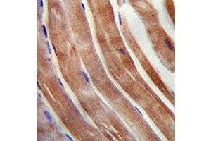 KEAP1 antibody immunohistochemistry analysis in formalin fixed and paraffin embedded human skeletal muscle.