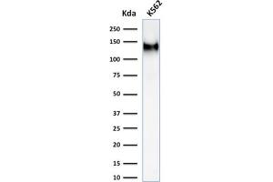 Western Blot Analysis of K562 cell lysate using CD43 Mouse Recombinant Monoclonal Antibody (rSPN/1094). (Recombinant CD43 anticorps)