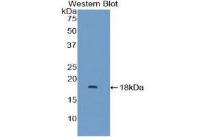 Detection of Recombinant MAPKSP1, Human using Polyclonal Antibody to Mitogen Activated Protein Kinase Scaffold Protein 1 (MAPKSP1) (MAPKSP1 anticorps  (AA 1-124))