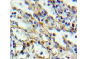 IHC-P analysis of Liver tissue, with DAB staining. (TLR6 anticorps  (AA 608-796))