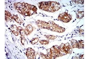 Immunohistochemical analysis of paraffin-embedded stomach tissues using CTNNA1 mouse mAb with DAB staining.