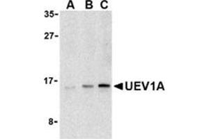Western blot analysis of UEV1A in Jurkat cell lysates with this product at (A) 1, (B) 2, and (C) 4 μg/ml. (UBE2V1 anticorps  (C-Term))