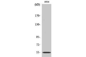 Western Blotting (WB) image for anti-Cytochrome P450, Family 2, Subfamily D, Polypeptide 6 (CYP2D6) (Internal Region) antibody (ABIN6282326)