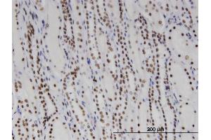 Immunoperoxidase of monoclonal antibody to DDX11 on formalin-fixed paraffin-embedded human kidney.