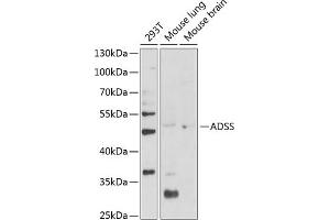 Western blot analysis of extracts of various cell lines, using ADSS Antibody (ABIN6131467, ABIN6136604, ABIN6136606 and ABIN6216015) at 1:1000 dilution. (ADSS anticorps  (AA 1-280))