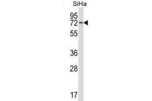 Western Blotting (WB) image for anti-Heat Shock 70kD Protein 12B (HSPA12B) antibody (ABIN2997411)