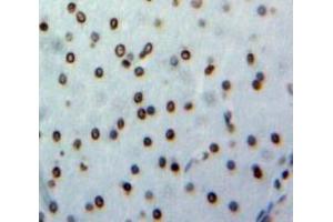 anti-TATA Box Binding Protein (TBP) (AA 8-316) antibody