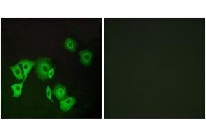 Immunofluorescence analysis of A549 cells, using TTF2 Antibody. (TTF2 anticorps  (AA 51-100))