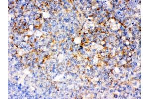 CD14 was detected in paraffin-embedded sections of human tonsil tissues using rabbit anti- CD14 Antigen Affinity purified polyclonal antibody at 1 μg/mL.