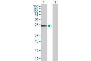 Lane 1: HOXB5 transfected lysate ( 29.