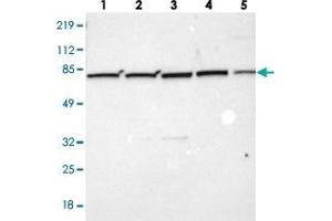 Western blot analysis of Lane 1: Human cell line RT-4, Lane 2: Human cell line U-251MG sp, Lane 3: Human cell line A-431, Lane 4: Human liver tissue, Lane 5: Human tonsil tissue with ZC3H12B polyclonal antibody . (ZC3H12B anticorps)