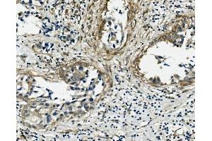 IHC analysis of VCL using anti-VCL antibody (ABIN7599003). (Vinculin anticorps  (AA 1-149))