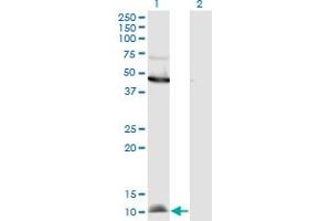 Western Blot analysis of CCL2 expression in transfected 293T cell line by CCL2 monoclonal antibody (M11), clone 3H7. (CCL2 anticorps  (AA 1-99))