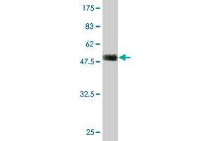 Western Blot detection against Immunogen (51. (TGIF2 anticorps  (AA 1-237))