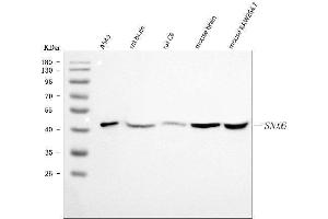 Western blot analysis of SNX6 using anti-SNX6 antibody (ABIN7599362).