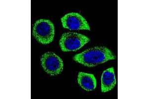 Confocal immunofluorescent analysis of PIP5KL1 Antibody (N-term) (ABIN655244 and ABIN2844847) with U-251MG cell followed by Alexa Fluor 488-conjugated goat anti-rabbit lgG (green).