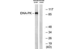 Western blot analysis of extracts from mouse brain cells, using Dynamin-1 (Ab-774) Antibody. (Dynamin 1 anticorps  (AA 740-789))