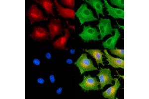 ABIN6264492 and ABIN6279008 staining  cells by IF/ICC.