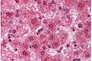 anti-Tripartite Motif Containing 14 (TRIM14) (AA 116-165) antibody