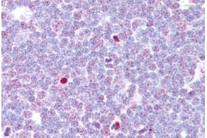 Anti-CAMK4 antibody IHC staining of human thymus. (CAMK4 anticorps  (AA 166-215))