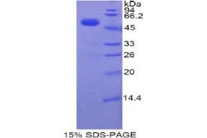 SDS-PAGE analysis of Human TFAM Protein. (TFAM Protéine)